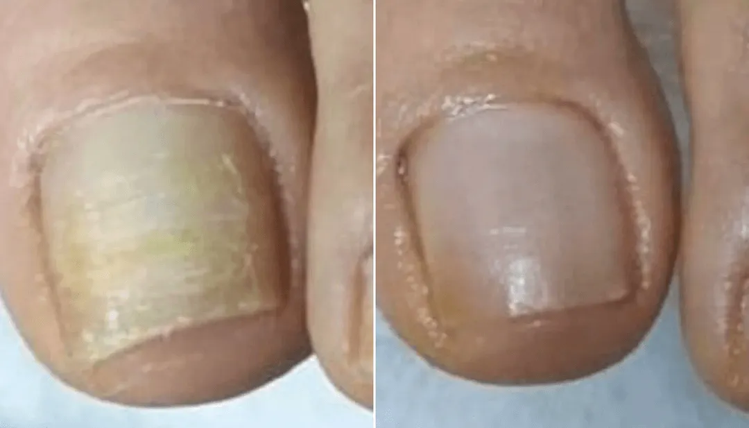 Before and After Results